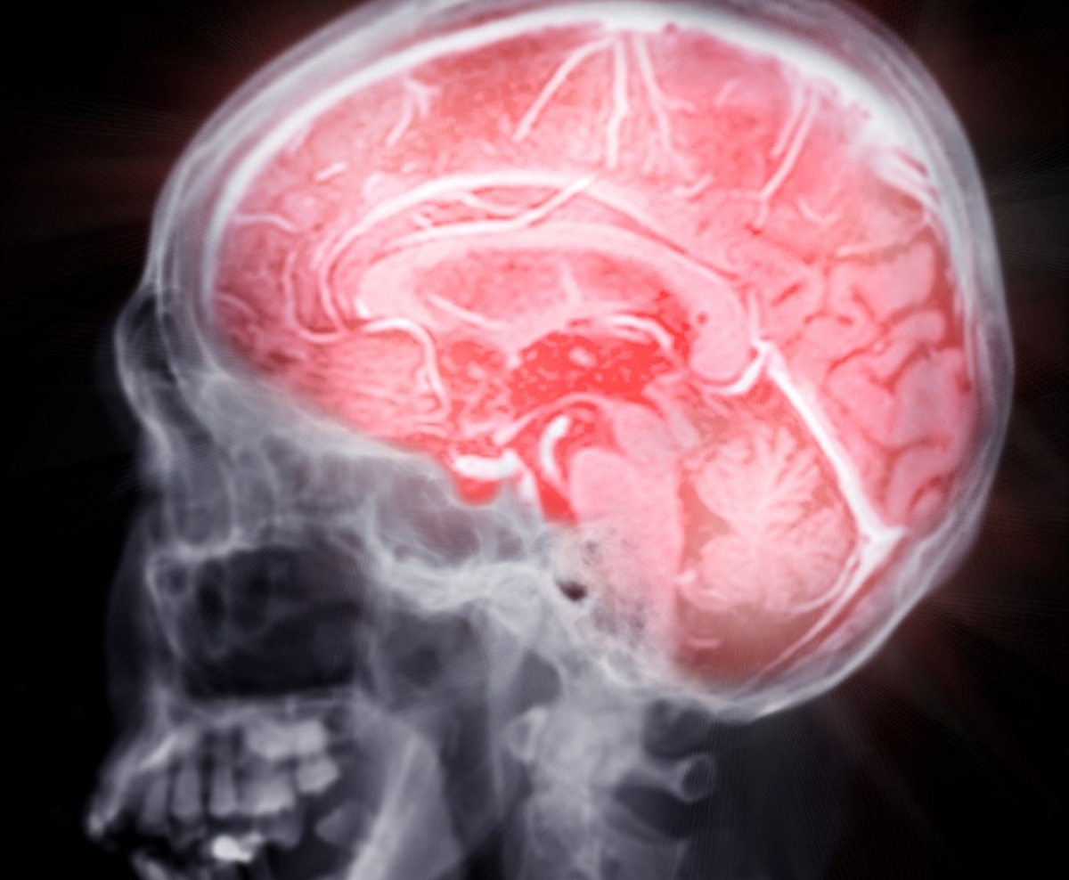 Egy emberi agy MRI képe