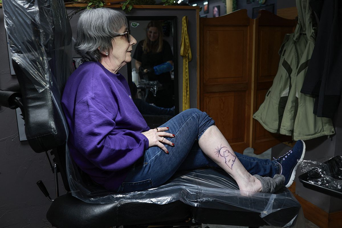 Napfogyatkozás-minta egy idős nő lábán.