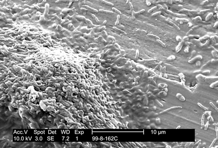 Így néz ki a Legionella Pneumophila