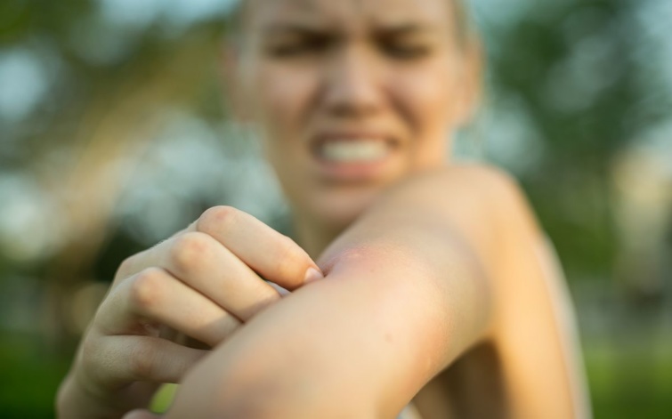 Egy nő a feldagadt szúnyogcsípést nézi a karján.